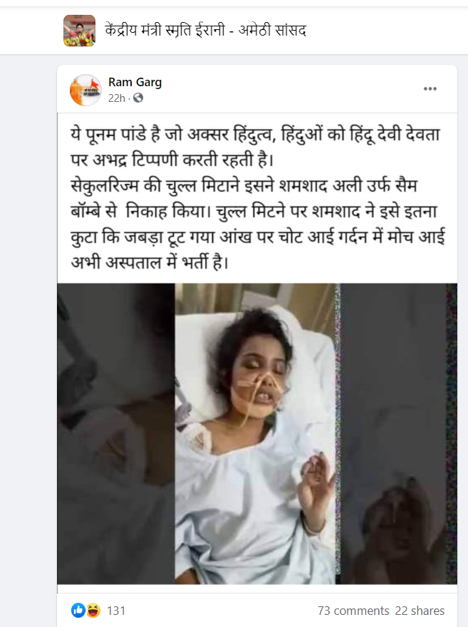 क्या मॉडल तथा अभिनेत्री पूनम पांडेय के पति सैम अहमद बॉम्बे द्वारा उनकी बेरहम पिटाई के बाद उन्हें अस्पताल में भर्ती कराने के बाद की है यह तस्वीर?