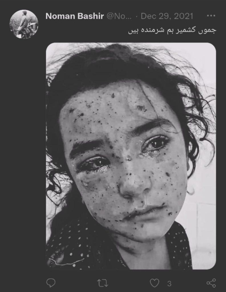 زخمی لڑکی کی تصویر جموں کشمیر کی نہیں ہے