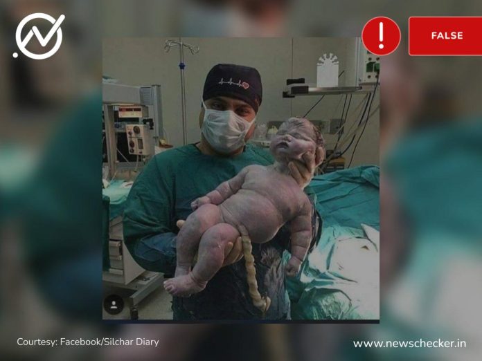 Viral photo is not of world’s biggest baby, weighing 8.6kg, as there have been records of heavier babies.